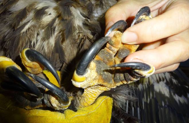 The eaglet is now recovering following surgery for a femur fracture on its right leg, which was burned by power lines.